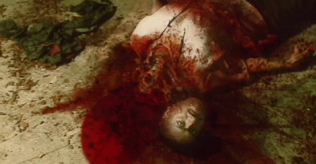 acid bath